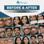 Battissi | Whitening Teeth Powder